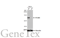 Anti-PCSK9 antibody used in Western Blot (WB). GTX129859