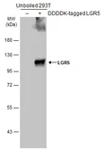 Anti-LGR5 antibody used in Western Blot (WB). GTX129862