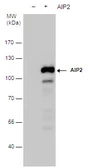 Anti-AIP2 antibody used in Western Blot (WB). GTX129863