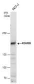 Anti-KDM5B antibody used in Western Blot (WB). GTX129872