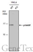 Anti-CDKN2A / p14ARF antibody used in Western Blot (WB). GTX129902