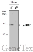 Anti-CDKN2A / p14ARF antibody used in Western Blot (WB). GTX129902