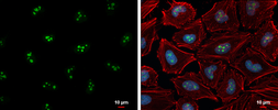 Anti-CDKN2A / p14ARF antibody used in Immunocytochemistry/ Immunofluorescence (ICC/IF). GTX129903