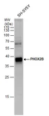 Anti-PHOX2B antibody used in Western Blot (WB). GTX129908