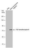 Anti-TGF beta Receptor 2 antibody used in Western Blot (WB). GTX129909