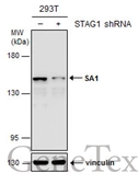 Anti-SA1 antibody used in Western Blot (WB). GTX129912
