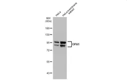 Anti-OPA1 antibody used in Western Blot (WB). GTX129917