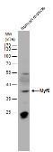 Anti-MYF5 antibody used in Western Blot (WB). GTX129925