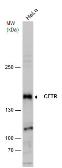 Anti-CFTR antibody used in Western Blot (WB). GTX129939