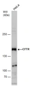 Anti-CFTR antibody used in Western Blot (WB). GTX129939