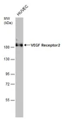 Anti-VEGF Receptor 2 antibody used in Western Blot (WB). GTX129943
