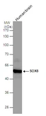 Anti-SOX8 antibody used in Western Blot (WB). GTX129949