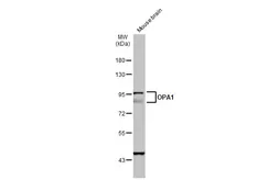 Anti-OPA1 antibody used in Western Blot (WB). GTX129952