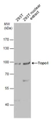 Anti-Topoisomerase I antibody used in Western Blot (WB). GTX129960
