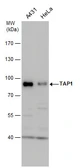 Anti-TAP1 antibody used in Western Blot (WB). GTX129963