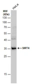 Anti-SIRT4 antibody used in Western Blot (WB). GTX129978