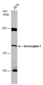 Anti-Desmoglein 1 antibody used in Western Blot (WB). GTX129983