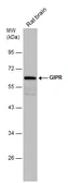 Anti-GIPR antibody used in Western Blot (WB). GTX129984