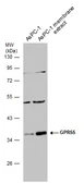 Anti-GPR55 antibody used in Western Blot (WB). GTX129989