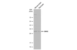 Anti-EMX2 antibody used in Western Blot (WB). GTX129992