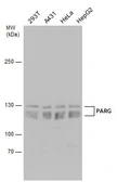 Anti-PARG antibody used in Western Blot (WB). GTX130002