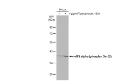 Anti-eIF2 alpha (phospho Ser51) antibody used in Western Blot (WB). GTX130006