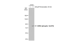 Anti-GRK2 (phospho Ser670) antibody used in Western Blot (WB). GTX130007