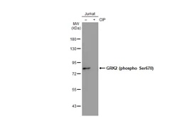 Anti-GRK2 (phospho Ser670) antibody used in Western Blot (WB). GTX130007