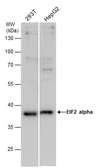 Anti-eIF2 alpha antibody used in Western Blot (WB). GTX130011
