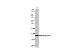 Anti-eIF2 alpha antibody used in Western Blot (WB). GTX130011