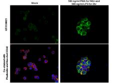 Anti-IL1 beta antibody used in Immunocytochemistry/ Immunofluorescence (ICC/IF). GTX130021