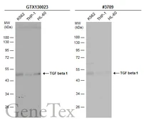 Anti-TGF beta 1 antibody used in Western Blot (WB). GTX130023