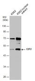 Anti-E2F2 antibody used in Western Blot (WB). GTX130030