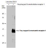 Anti-Somatostatin receptor 1 antibody used in Western Blot (WB). GTX130041
