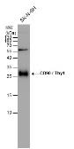 Anti-CD90 antibody used in Western Blot (WB). GTX130047
