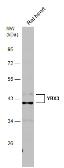 Anti-CSDA antibody used in Western Blot (WB). GTX130052