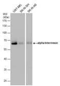 Anti-alpha Internexin antibody used in Western Blot (WB). GTX130053