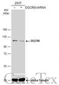 Anti-DGCR8 antibody used in Western Blot (WB). GTX130061