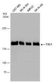 Anti-Hamartin / TSC1 antibody used in Western Blot (WB). GTX130062