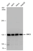 Anti-SMC2 antibody used in Western Blot (WB). GTX130078
