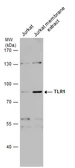 Anti-TLR1 antibody used in Western Blot (WB). GTX130079