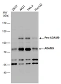 Anti-ADAM9 antibody used in Western Blot (WB). GTX130081