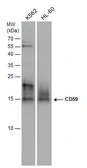 Anti-CD59 antibody used in Western Blot (WB). GTX130096