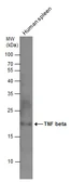 Anti-TNF beta antibody used in Western Blot (WB). GTX130100