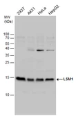 Anti-LSM1 antibody used in Western Blot (WB). GTX130104