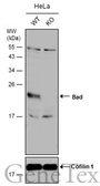 Anti-Bad antibody used in Western Blot (WB). GTX130108