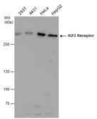 Anti-IGF2R antibody used in Western Blot (WB). GTX130109