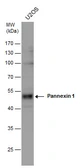 Anti-Pannexin 1 antibody used in Western Blot (WB). GTX130121