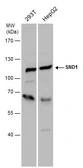 Anti-SND1 antibody used in Western Blot (WB). GTX130135