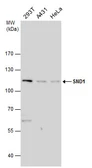 Anti-SND1 antibody used in Western Blot (WB). GTX130136
